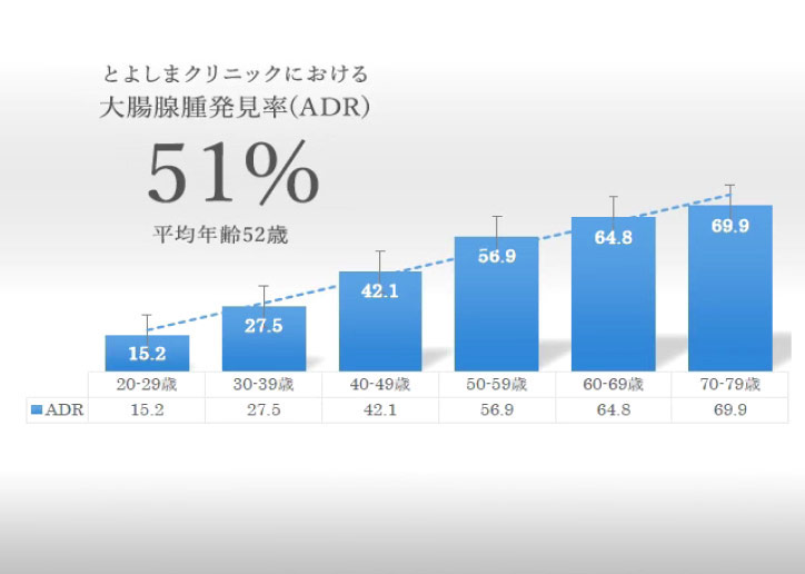 大腸線種発見率(ADR)の高い内視鏡検査で、大腸がんの発生を早期予防