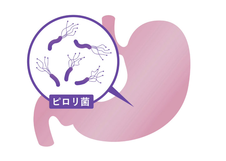 検査時にその場で行えるピロリ菌の検査・除菌
