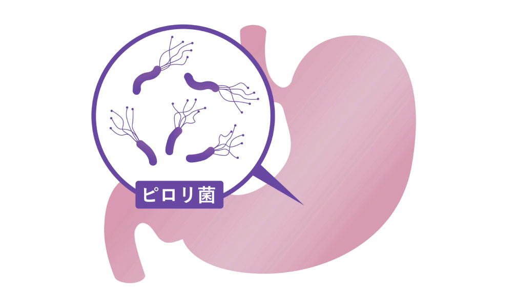 検査時にその場で行えるピロリ菌の検査・除菌